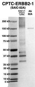 Click to enlarge image Western Blot using CPTC-ERBB2-1 as primary Ab against HEK293T cell lysate containing HER2 variant 1 (from Origene) in lane 2. Also included are molecular wt. standards (lane 1) and the Erbb2-1 Ab as the IgG control (lane 3).