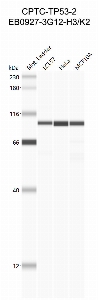 Click to enlarge image Western Blot using CPTC-TP53-2 as primary antibody against cell lysates LCL57 (lane 2), HeLa (lane 3) and MCF10A (lane 4). Also included are molecular weight standards (lane 1).