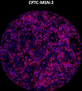 Click to enlarge image Imaging mass cytometry on normal spleen tissue core using CPTC-MSN-2 metal-labeled antibody.  Data shows an overlay of the target protein signal (red) and DNA (blue). Dilution: 1:100 of 0.5mg/mL stock. Signal was also obtained in other normal tissues (liver, bone marrow, spleen, prostate, colon, pancreas, breast, lung, testis, endometrium, and appendix) and cancer tissues (breast, prostate, colon, ovarian, and lung).