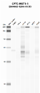 Click to enlarge image Automated western blot using CPTC-MST1-1 as primary antibody against PBMC (lane 2), HeLa (lane 3), Jurkat (lane 4), A549 (lane 5), MCF7 (lane 6), and NCI-H226 (lane 7) whole cell lysates.  Expected molecular weight - 55.6 kDa and 52.3 kDa.  Molecular weight standards are also included (lane 1). PBMC is positive. Jurkat and A549 are presumed positive.  All other cell lines are negative.