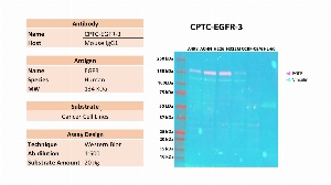 Click to enlarge image Western blot using CPTC-EGFR-3 as primary antibody against the whole cell lysates of A498, ACHN, H226, H322M, CCRF-CEM and HL-60. The antibody is able to detect the target protein in the cell lines A498, ACHN, H226 and H322M. Expected MW is 134 KDa. The same membrane was probed with an anti-Vinculin antibody. Vinculin was detected in  A498, ACHN, H226 and H322M, and weakly in CCRF-CEM and HL-60.