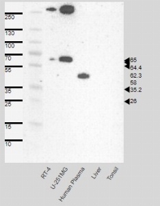 Click to enlarge image Results provided by the Human Protein Atlas (www.proteinatlas.org). Band of predicted size in kDa (+/-20%) with additional bands present.
Analysis performed using a standard panel of samples. Antibody dilution: 1:500