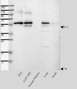 Click to enlarge image Results provided by the Human Protein Atlas (www.proteinatlas.org). Band of predicted size in kDa (+/-20%) with additional bands present. Analysis performed using a standard panel of samples. Antibody dilution: 1:500