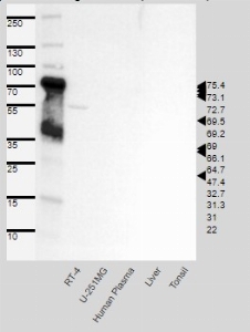 Click to enlarge image Single band corresponding to the predicted size in kDa (+/-20%).
Analysis performed using a standard panel of samples. Antibody dilution: 1:500