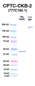 Click to enlarge image Western Blot using CPTC-CKB-2 as primary Ab against CKB (Ag 10328) (lane 2). Also included are molecular wt. standards (lane 1) and mouse IgG control (lane 3).