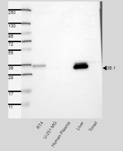 Click to enlarge image Results provided by the Human Protein Atlas (www.proteinatlas.org). ingle band corresponding to the predicted size in kDa (+/-20%). Analysis performed using a standard panel of samples. Antibody dilution: 1:500.