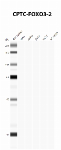 Click to enlarge image Automated Western Blot using CPTC-FOXO3-2 as primary antibody against cell lysates A549, H226, HeLa, Jurkat and MCF7. Expected MW of 71.3 KDa. All cell lysates negative.  Molecular weight standards are also included (lane 1).
