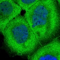 Click to enlarge image Results provided by the Human Protein Atlas (www.proteinatlas.org). The subcellular location is supported by literature. Immunofluorescent staining of human cell line A-431 shows localization to nucleoplasm, plasma membrane & cytosol. Human assay: A-431 fixed with PFA, dilution: 1:20
Human assay: U-2 OS fixed with PFA, dilution: 1:20
Human assay: U-251 MG fixed with PFA, dilution: 1:20