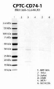 Click to enlarge image Western blot using CPTC-CD74-1 as primary antibody against HeLa (lane 2), Jurkat (lane 3), A549 (lane 4), MCF7 (lane 5) and NCI H226 (lane 6) cell lysates.  Expected molecular weight 34 kDa.  Molecular weight standards (MW Stds.) are also included (lane 1).  Positive for Jurkat and MCF7.  Negative/ inconclusive data for the other cell lines.