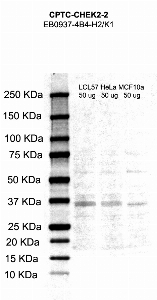 Click to enlarge image Western Blot using CPTC-CHEK2-2 as primary antibody against cell lysates LCL57 (lane 2), HeLa (lane 3) and MCF10A (lane 4). Also included are molecular weight standards (lane 1)