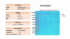Click to enlarge image Western blot using CPTC-EGFR-4 as primary antibody against the whole cell lysates of A498, ACHN, H226, H322M, CCRF-CEM and HL-60. The antibody is able to detect the target protein in the cell lines A498, ACHN, and H226. Expected MW is 134 KDa. The same membrane was probed with an anti-Vinculin antibody. Vinculin was detected in  A498, ACHN, H226 and H322M, and weakly in CCRF-CEM and HL-60.