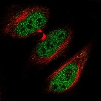 Click to enlarge image Results provided by the Human Protein Atlas (www.proteinatlas.org). The subcellular location is supported by literature. Immunofluorescent staining of human cell line HeLa shows localization to nucleoplasm & vesicles. Human assay: HeLa fixed with PFA, dilution: 1:2000
Human assay: MCF7 fixed with PFA, dilution: 1:2000
Human assay: U-2 OS fixed with PFA, dilution: 1:2000