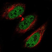 Click to enlarge image Results provided by the Human Protein Atlas (www.proteinatlas.org). The subcellular location is supported by literature. Immunofluorescent staining of human cell line HeLa shows localization to nucleoplasm & vesicles. Human assay: HeLa fixed with PFA, dilution: 1:2000
Human assay: MCF7 fixed with PFA, dilution: 1:2000
Human assay: U-2 OS fixed with PFA, dilution: 1:2000