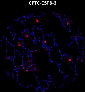 Click to enlarge image Imaging mass cytometry on normal lung cancer tissue core using CPTC-CSTB-3 metal-labeled antibody.  Data shows an overlay of the target protein signal (red) and DNA (blue). Dilution: 1:100 of 0.5mg/mL stock. Signal was also obtained in other normal tissues (liver, breast, lung, testis, endometrium, and appendix) and cancer tissues (lung, breast, and ovarian).