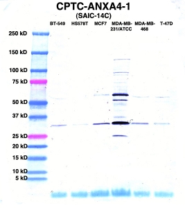 Click to enlarge image Western Blot using CPTC-ANXA4-1 as primary Ab against lysates from six breast cancer cell lines from the NCI60 cell line collection (lanes 2-7). Also included are molecular wt. standards (lane 1).