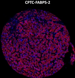 Click to enlarge image Imaging mass cytometry on normal liver tissue core using CPTC-FABP5-2 metal-labeled antibody.  Data shows an overlay of the target protein signal (red) and DNA (blue). Dilution: 1:100 of 0.5mg/mL stock. Signal was also obtained in other normal tissues (liver, bone marrow, spleen, placenta, prostate, colon, pancreas, breast, lung, testis, endometrium, appendix, and kidney) and cancer tissues (colon, breast, ovarian, lung, and prostate).