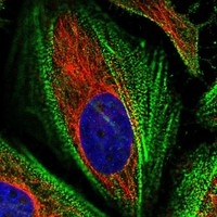 Click to enlarge image Results provided by the Human Protein Atlas (www.proteinatlas.org). The subcellular location is partly supported by literature or no literature is available. Immunofluorescent staining of human cell line HeLa shows localization to actin filaments. 
Human assay: HeLa fixed with PFA, dilution: 1:2000
Human assay: MCF7 fixed with PFA, dilution: 1:2000