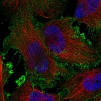 Click to enlarge image Results provided by the Human Protein Atlas (www.proteinatlas.org). The subcellular location is supported by literature. Immunofluorescent staining of human cell line U-251 MG shows localization to plasma membrane. 
Human assay: A-431 fixed with PFA, dilution: 1:2000
Human assay: U-251 MG fixed with PFA, dilution: 1:2000