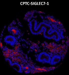 Click to enlarge image Imaging mass cytometry on normal endometrium tissue core using CPTC-SIGLEC7-1 metal-labeled antibody.  Data shows an overlay of the target protein signal (red) and DNA (blue). Dilution: 1:100 of 0.5mg/mL stock. Signal was also obtained in other normal tissues (testis, prostate, colon, endometrium, appendix, bone marrow, kidney, lung, and placenta) and cancer tissues (breast, colon, prostate, lung, and ovarian).