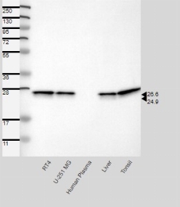 Click to enlarge image Results provided by the Human Protein Atlas (www.proteinatlas.org). Single band corresponding to the predicted size in kDa (+/-20%). Analysis performed using a standard panel of samples. Antibody dilution: 1:250.