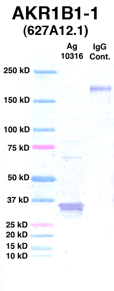 点击放大图像Western Blot，使用CPTC-AKR1B1-1作为Ag 10316的主要抗体（通道2）。还包括分子重量标准（通道1）和小鼠IgG控制（通道3）。