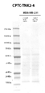 Click to enlarge image Western Blot usign CPTC-TNK2-4 as primary antibody against cell lysates of MDA-MB-231 cells treated (lane 2) and not treated (lane 3) with EGF (100 ng/mL0 for 10 minutes, after overnight starvation). Molecular weight standards are also included (lane 1). The antibody was not able to detect  the  phosphrylated target protein in the EGF treated cell lysate. Expected molecultar weight for TNK2 is about 114 KDa.