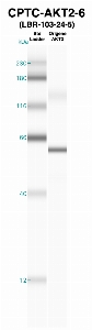 Click to enlarge image Western Blot using CPTC-AKT2-6 as primary Ab against recombinant AKT2 (lane 2). Also included are molecular wt. standards (lane 1).