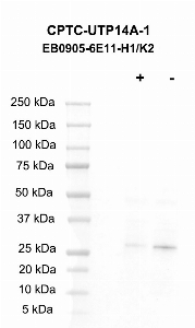 Click to enlarge image Western blot using CPTC-UTP14A-1 as primary antibody against LCL57 cell lysate.  Cell lysate was irradiated with 10 Gy as shown in the ‘+’ indicated lane.  Non-irradiated cell lysate was treated with alkaline phosphatase enzyme as shown in ‘-‘ indicated lane.  Blots were developed using enhanced chemiluminescence. Molecular weight standards are also included.