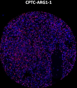 Click to enlarge image Imaging mass cytometry on normal spleen tissue core using CPTC-ARG1-1 metal-labeled antibody.  Data shows an overlay of the target protein signal (red) and DNA (blue). Dilution: 1:100 of 0.5mg/mL stock. Signal was also obtained in other normal tissues (bone marrow, spleen, placenta, testis, and endometrium) and cancer tissues (breast, ovarian, and lung).