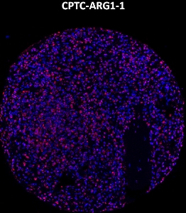 点击放大图像，使用CPTC-ARG1-1金属标记抗体对正常脾组织核心进行成像质量细胞术。数据显示了靶蛋白信号（红色）和DNA（蓝色）的重叠。稀释：0.5mg/mL储备液的1:100。在其他正常组织（骨髓、脾脏、胎盘、睾丸和子宫内膜）和癌组织（乳腺、卵巢和肺）中也获得了信号。