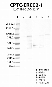 Click to enlarge image Western blot using CPTC-ERCC2-1 as primary antibody against HeLa (lane 2), Jurkat (lane 3), A549 (lane 4), MCF7 (lane 5) and NCI H226 (lane 6) cell lysates.  Expected molecular weight 87 kDa.  Molecular weight standards (MW Stds.) are also included (lane 1).  Positive for cell lines Jurkat, MCF7 and NCI H226.  Negative/inconsistent results for the other cell lines.