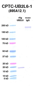 Click to enlarge image Western Blot using CPTC-UB2L6-1 as primary Ab against UB2L6 (rAg 00012) (lane 2). Also included are molecular wt. standards (lane 1) and mouse IgG control (lane 3).