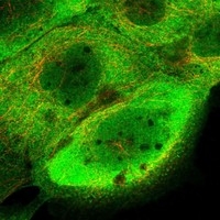 Click to enlarge image Results provided by the Human Protein Atlas (www.proteinatlas.org). The subcellular location is supported by literature. Immunofluorescent staining of human cell line A-431 shows localization to nucleoplasm, plasma membrane & cytosol. Human assay: A-431 fixed with PFA, dilution: 1:200
Human assay: U-2 OS fixed with PFA, dilution: 1:200
Human assay: U-251 MG fixed with PFA, dilution: 1:200