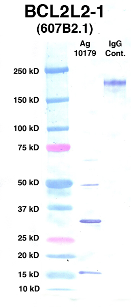 点击放大图像Western Blot，使用CPTC-BCL2L2-1作为Ag 10179的主要抗体（通道2）。还包括分子重量标准（通道1）和小鼠IgG控制（通道3）。