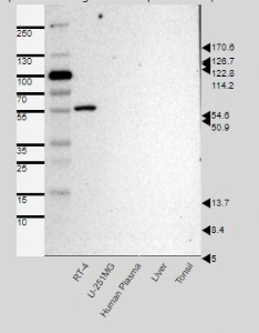 Click to enlarge image Results provided by the Human Protein Atlas (www.proteinatlas.org). Single band corresponding to the predicted size in kDa (+/-20%).
Analysis performed using a standard panel of samples. Antibody Dilution 1:500