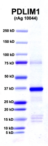 Click to enlarge image PAGE of PDLIM1 (rAg 10044) with molecular weight standards in lane 1