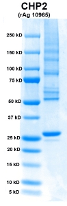 Click to enlarge image PAGE of CHP2 (rAg 10965) with molecular weight standards in lane 1