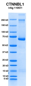 Click to enlarge image PAGE of CTNNBL1 (rAg 11057) with molecular weight standards in lane 1