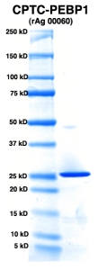 Click to enlarge image PAGE of PEBP1 (rAg 00060) with molecular weight standards in lane 1 
