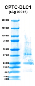 Click to enlarge image PAGE of DLC1 (rAg 00016) with molecular weight standards in lane 1.