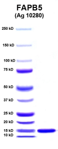 Click to enlarge image PAGE of Ag 10280 with molecular weight standards in lane 1