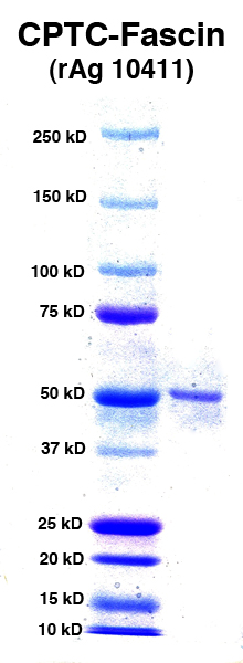 Click to enlarge image PAGE of Fascin (rAg 10411) with molecular weight standards in lane 1.