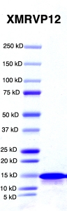 Click to enlarge image PAGE of XMRVP12 (Ag 0003) with molecular weight standards in lane 1