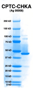 Click to enlarge image PAGE of CHKA (Ag 0008) with molecular weight standards in lane 1