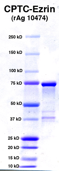 Click to enlarge image PAGE of Ag 10474 (with molecular weight standards in lane 1)