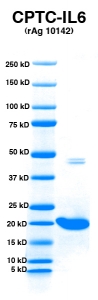 Click to enlarge image PAGE of IL6 (rAg 10142) with molecular weight standards in lane 1