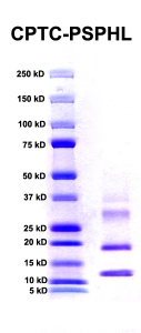 Click to enlarge image PAGE of Ag 00002 (PSPHL) (with molecular weight standards in lane 1)