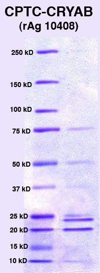 Click to enlarge image PAGE of Ag 10408 (with molecular weight standards in lane 1)