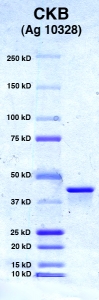 Click to enlarge image PAGE of Ag 10328 with molecular weight standards (lane 1)